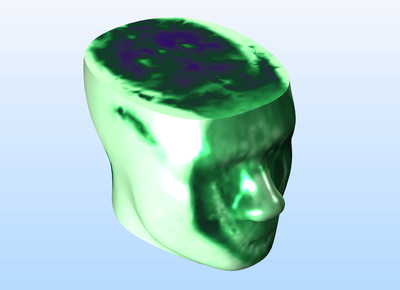 Specific Absorption Rate (SAR) in the Human Brain