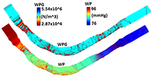 Influence of Non-Newtonian Blood Viscosity on Wall Pressure in Right ...